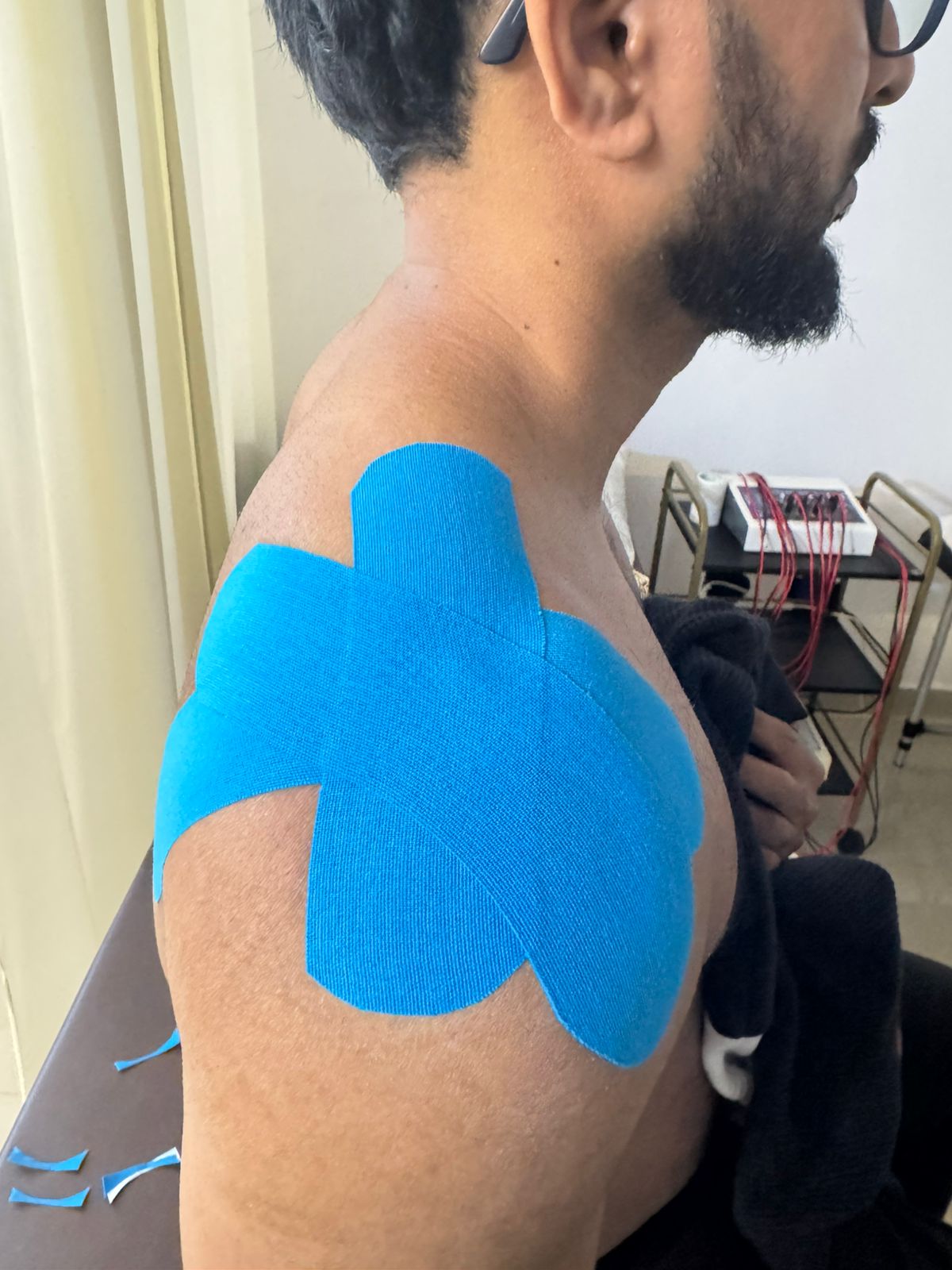 Shoulder Taping